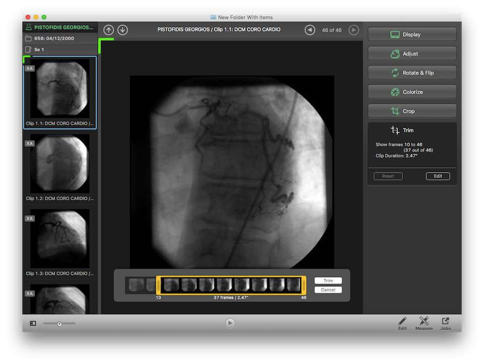 EscapeEMV - Gemaakt door PostDICOM